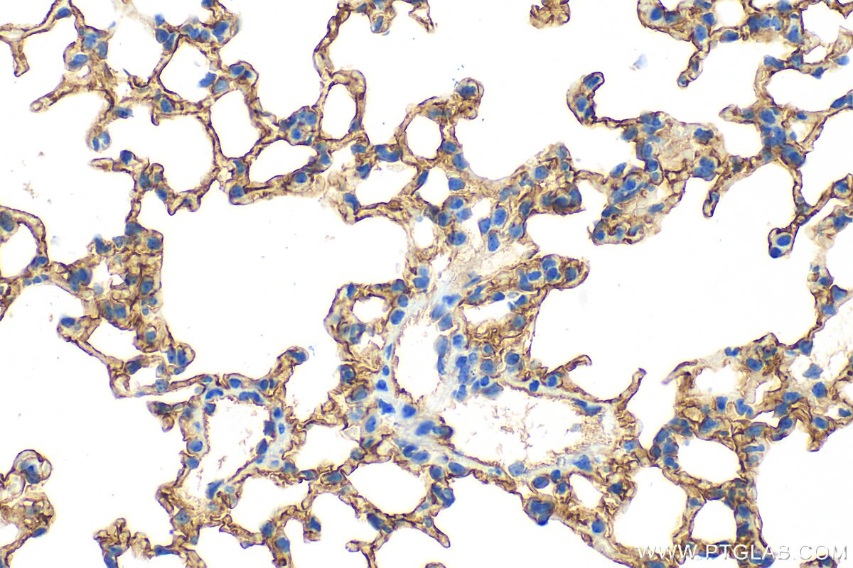 Immunohistochemistry (IHC) staining of mouse lung tissue using ICAM-1 Polyclonal antibody (31451-1-AP)