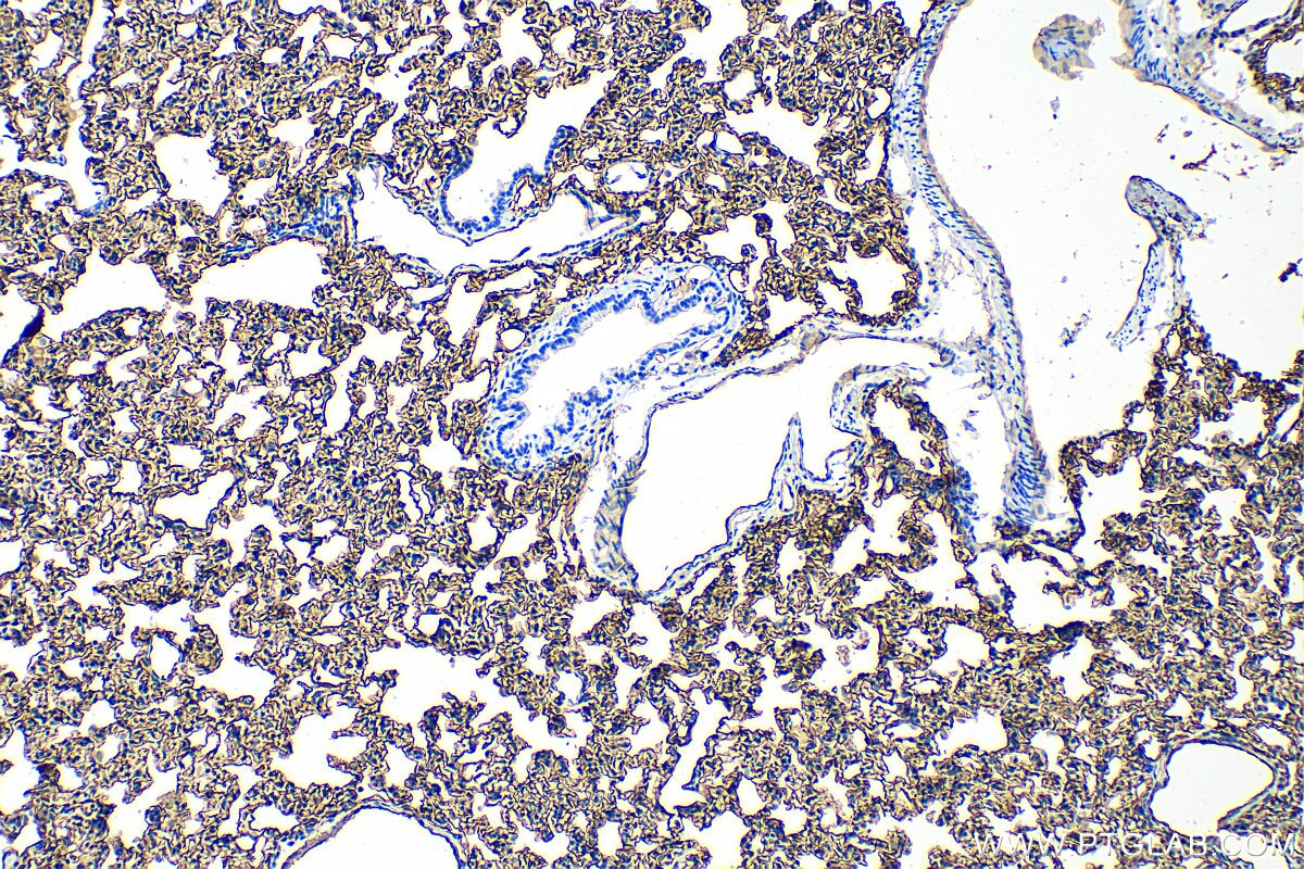 Immunohistochemistry (IHC) staining of rat lung tissue using ICAM-1 Polyclonal antibody (31451-1-AP)
