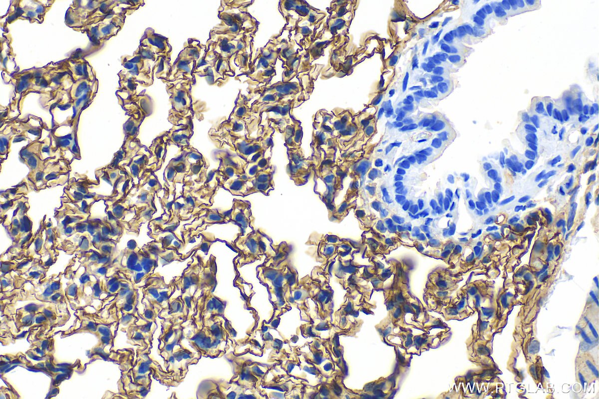 Immunohistochemistry (IHC) staining of rat lung tissue using ICAM-1 Polyclonal antibody (31451-1-AP)