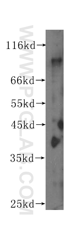 Western Blot (WB) analysis of human heart tissue using ICAM-1 Monoclonal antibody (60148-1-Ig)
