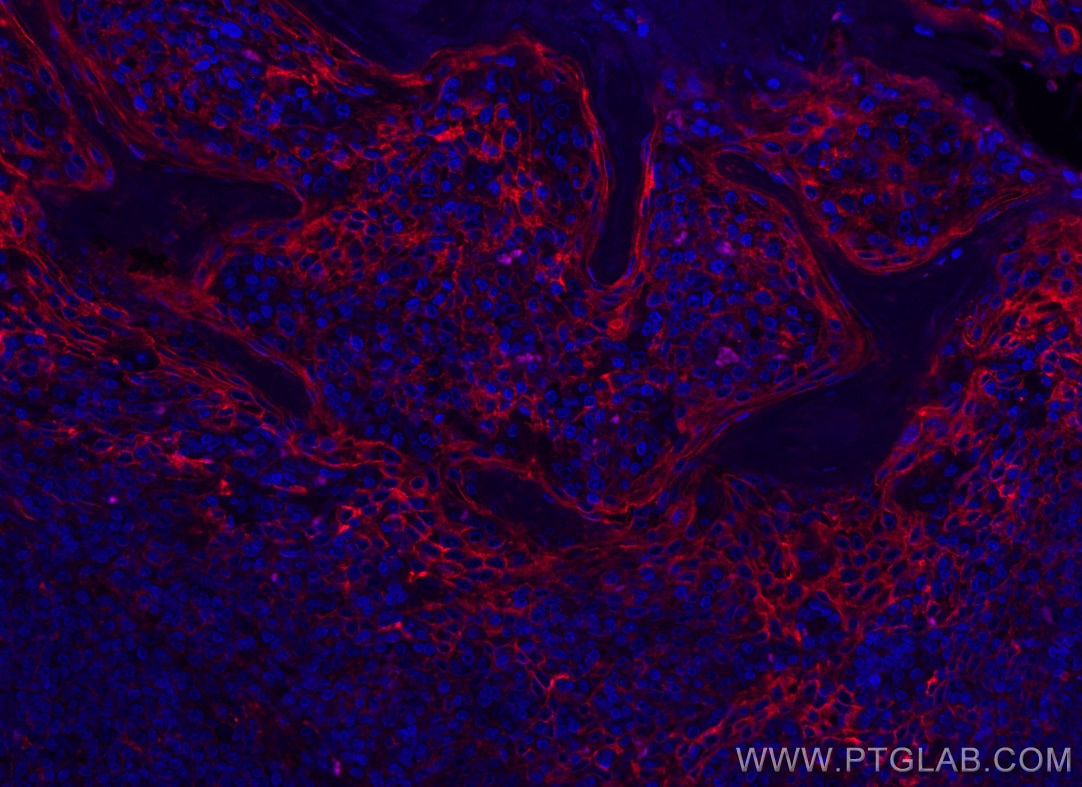 Immunofluorescence (IF) / fluorescent staining of human tonsillitis tissue using ICAM-1/CD54 Monoclonal antibody (60299-1-Ig)