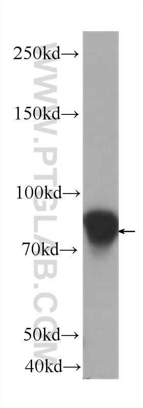 ICAM-1 Monoclonal antibody