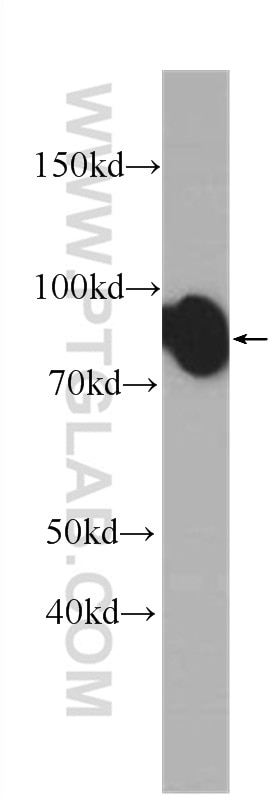 Western Blot (WB) analysis of HeLa cells using ICAM-1 Monoclonal antibody (60299-1-Ig)