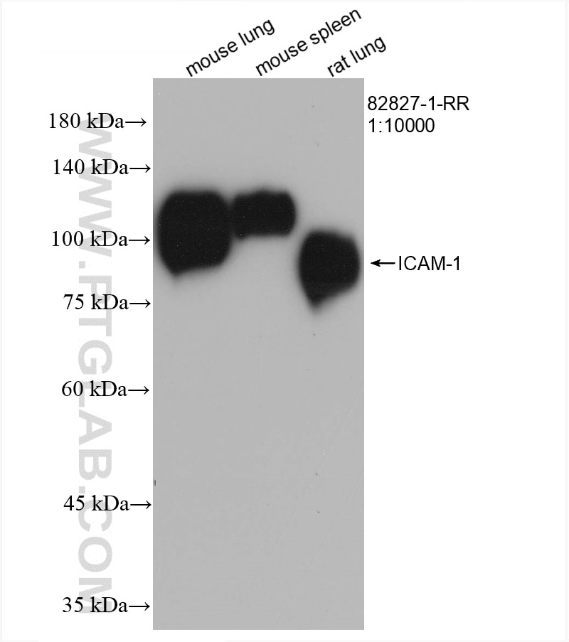 Western Blot (WB) analysis of various lysates using ICAM-1 Recombinant antibody (82827-1-RR)