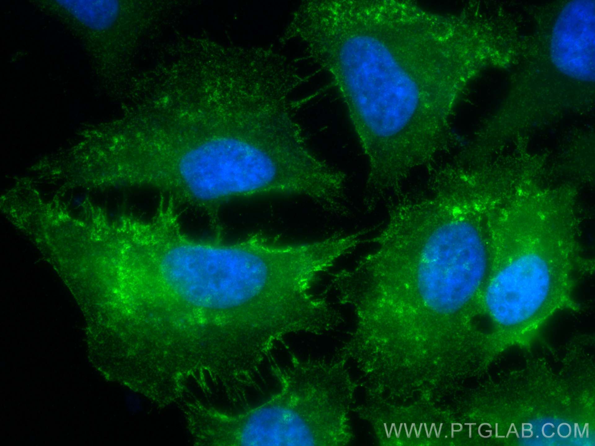 Immunofluorescence (IF) / fluorescent staining of HeLa cells using ICAM-1 Recombinant antibody (83069-6-RR)