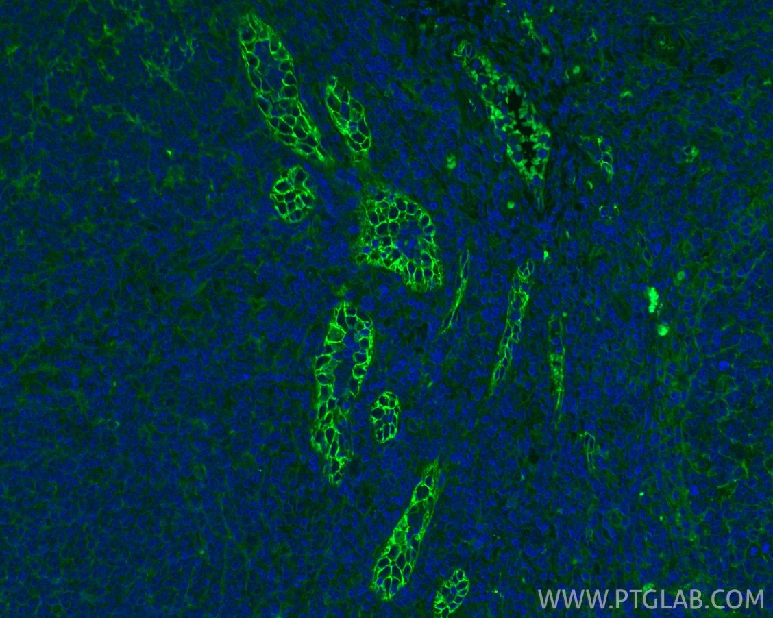 Immunofluorescence (IF) / fluorescent staining of human tonsillitis tissue using CoraLite® Plus 488-conjugated ICAM-1/CD54 Polyclon (CL488-10831)