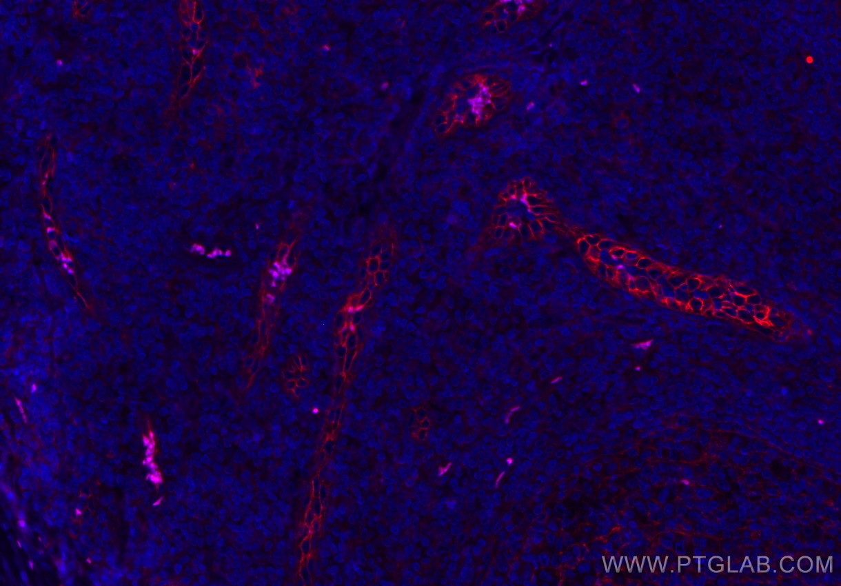 Immunofluorescence (IF) / fluorescent staining of human tonsillitis tissue using CoraLite®594-conjugated ICAM-1/CD54 Polyclonal ant (CL594-10831)