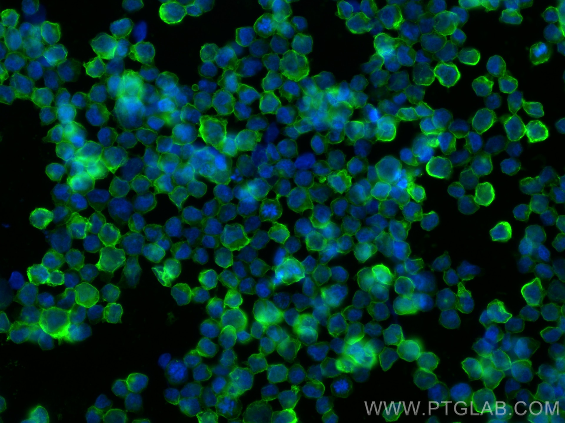 Immunofluorescence (IF) / fluorescent staining of Raji cells using Multi-rAb® ICAM-1/CD54 Multi-Recombinant antibody (RMX00016)
