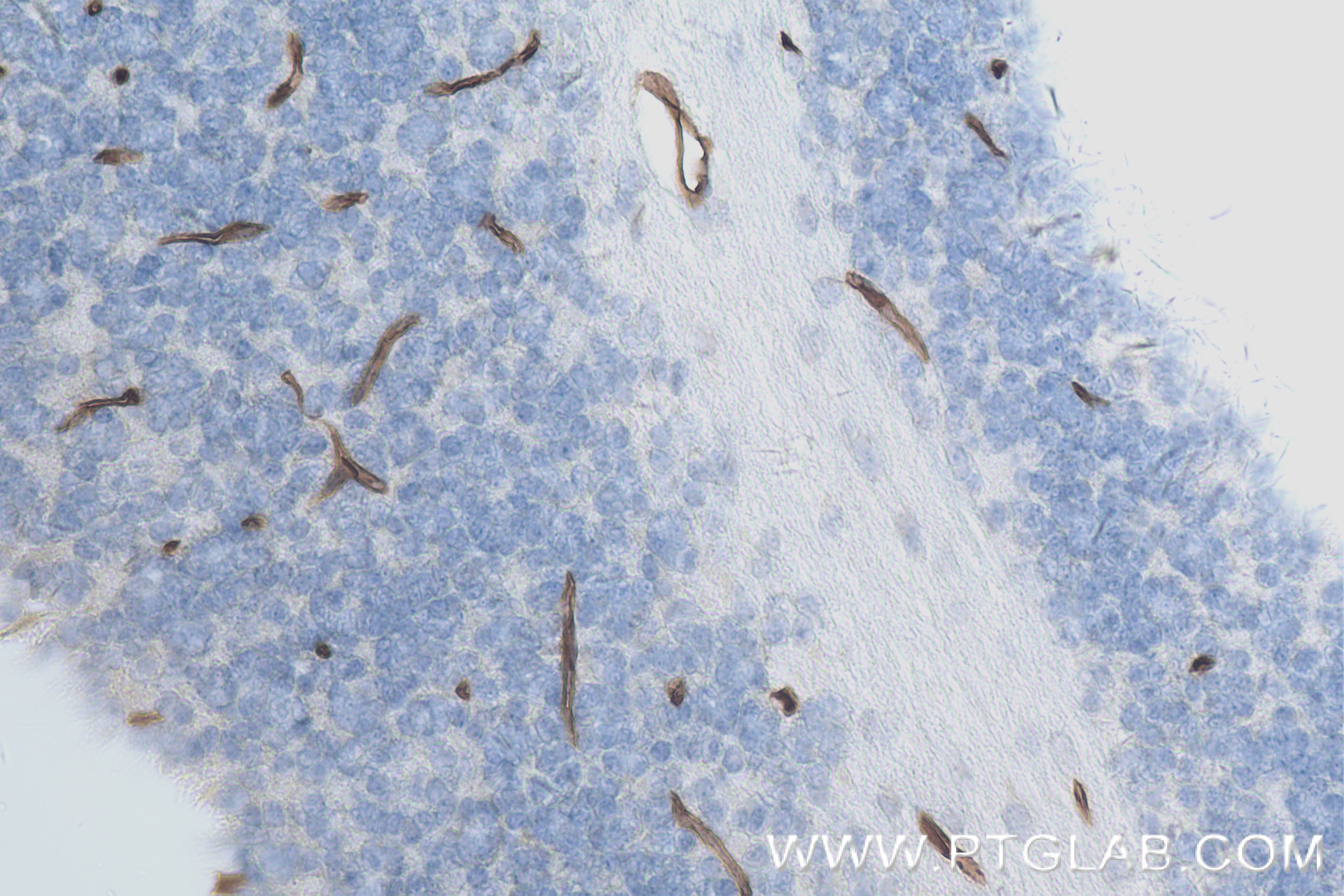 Immunohistochemistry (IHC) staining of mouse cerebellum tissue using ICAM-2/CD102 Recombinant antibody (84442-1-RR)