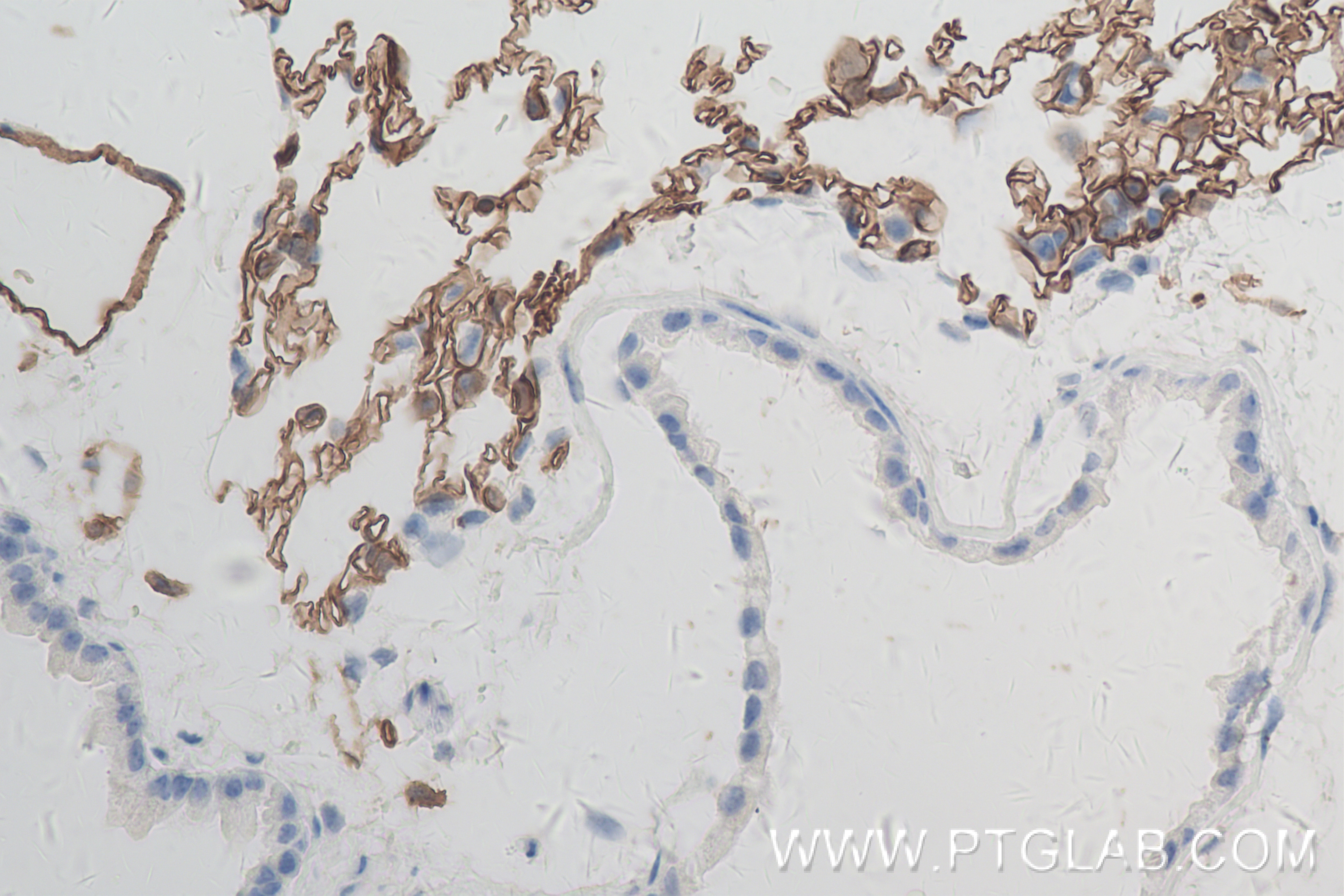 Immunohistochemistry (IHC) staining of mouse lung tissue using ICAM-2/CD102 Recombinant antibody (84442-1-RR)