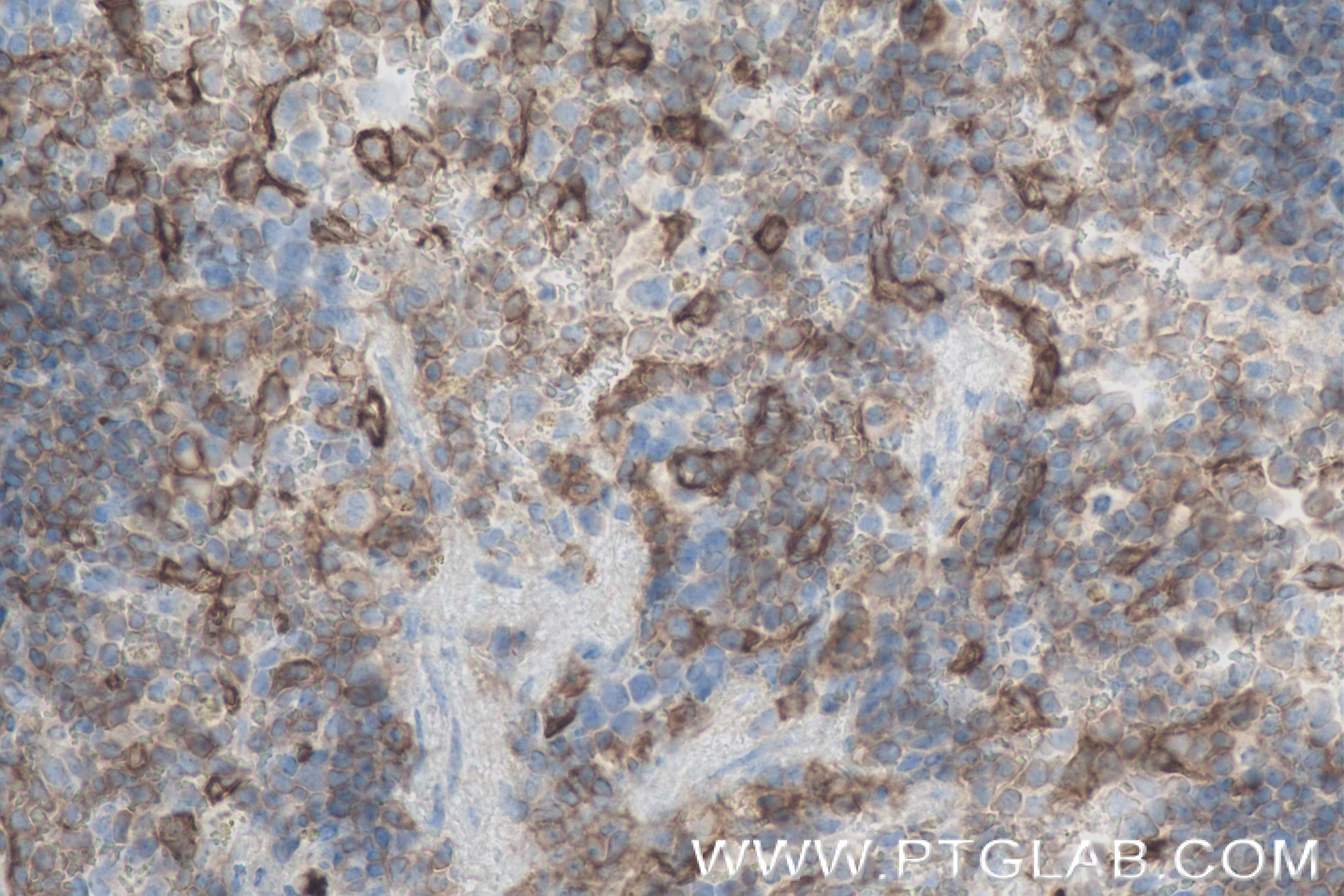 Immunohistochemistry (IHC) staining of mouse spleen tissue using ICAM-2/CD102 Recombinant antibody (84442-1-RR)