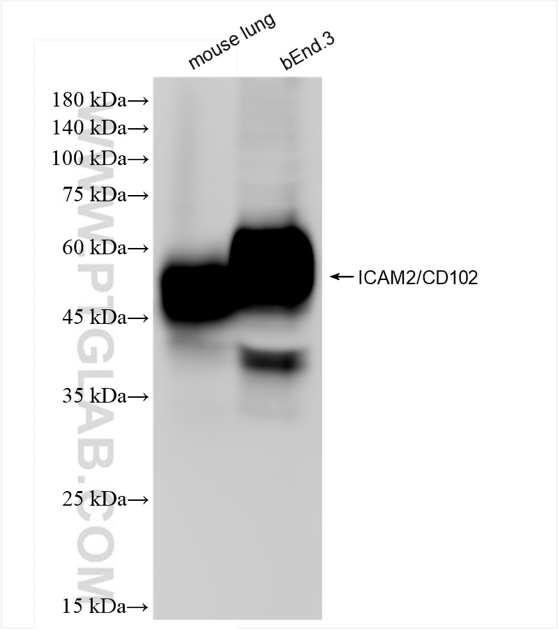 Western Blot (WB) analysis of various lysates using ICAM-2/CD102 Recombinant antibody (84442-1-RR)