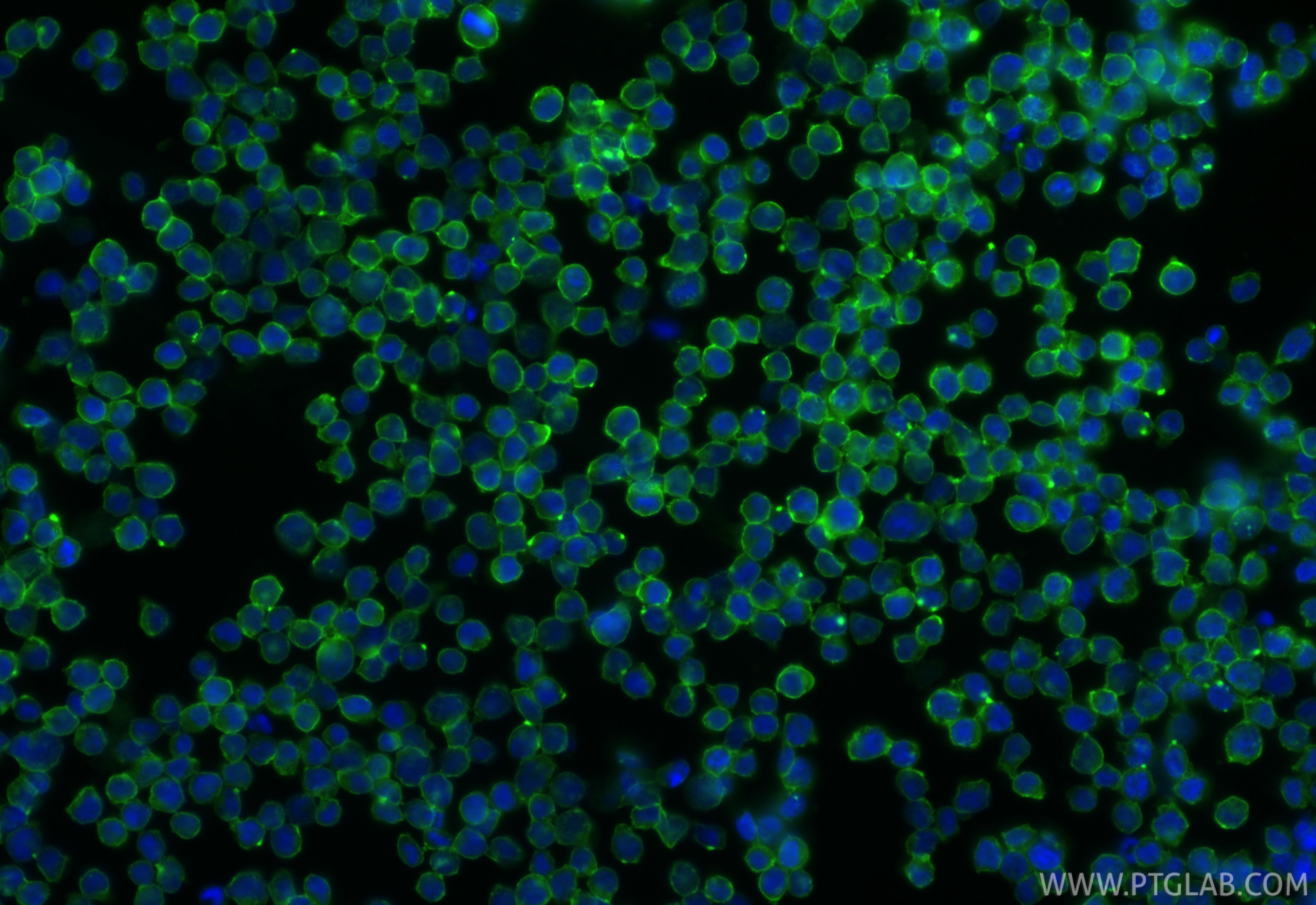 Immunofluorescent analysis of (4% PFA) fixed Jurkat cells using ICAM-2/CD102 antibody (84857-2-RR, Clone: 242237F8 ) at dilution of 1:200 and CoraLite®488-Conjugated Goat Anti-Rabbit IgG(H+L) (SA00013-2). This data was developed using the same antibody clone with 84857-2-PBS in a different storage buffer formulation. Immunofluorescence (IF) / fluorescent staining of Jurkat cells using ICAM-2/CD102 Recombinant monoclonal antibody (84857-2-RR)