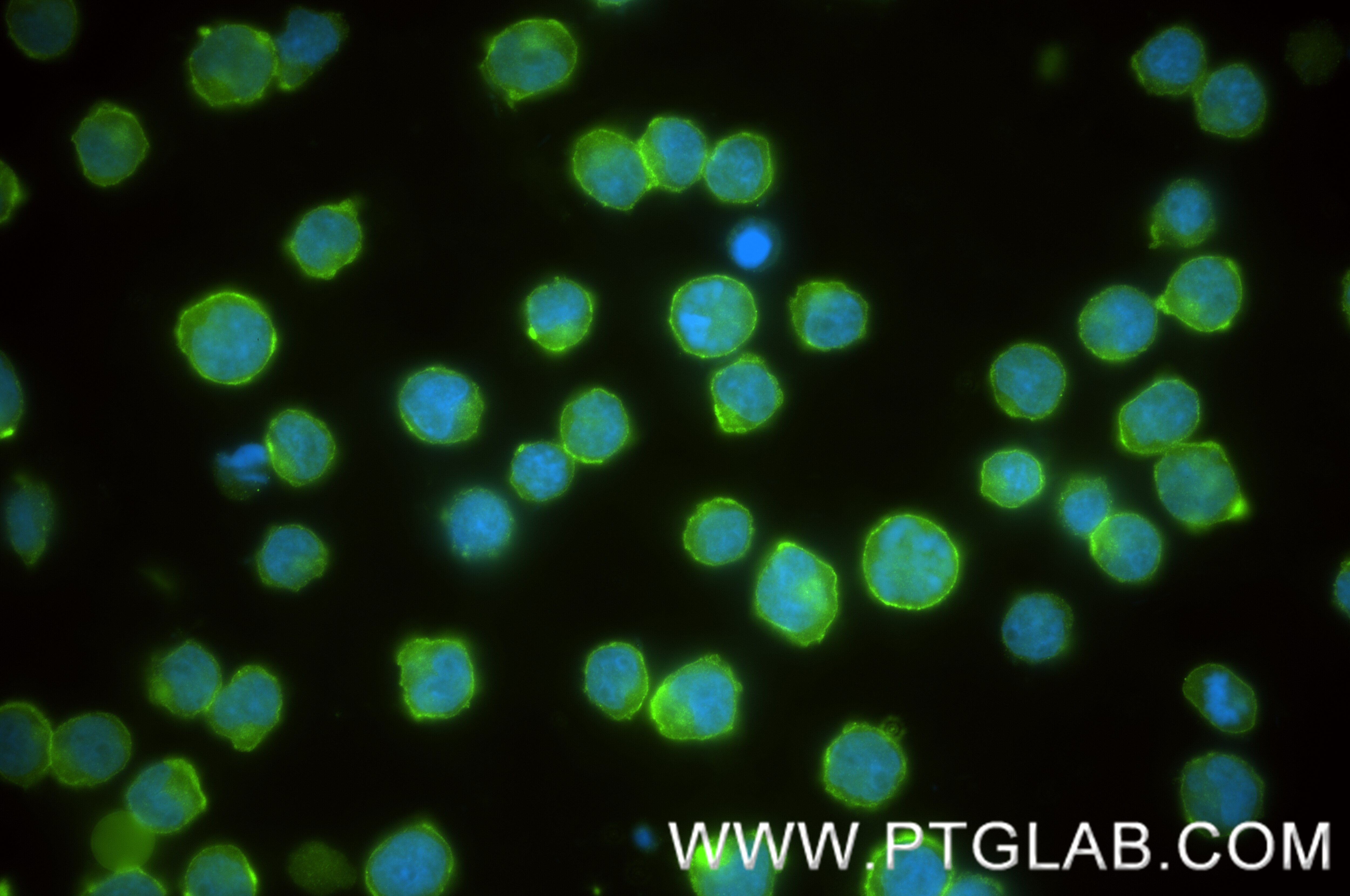 Immunofluorescence (IF) / fluorescent staining of Jurkat cells using ICAM-2/CD102 Recombinant antibody (84857-3-RR)