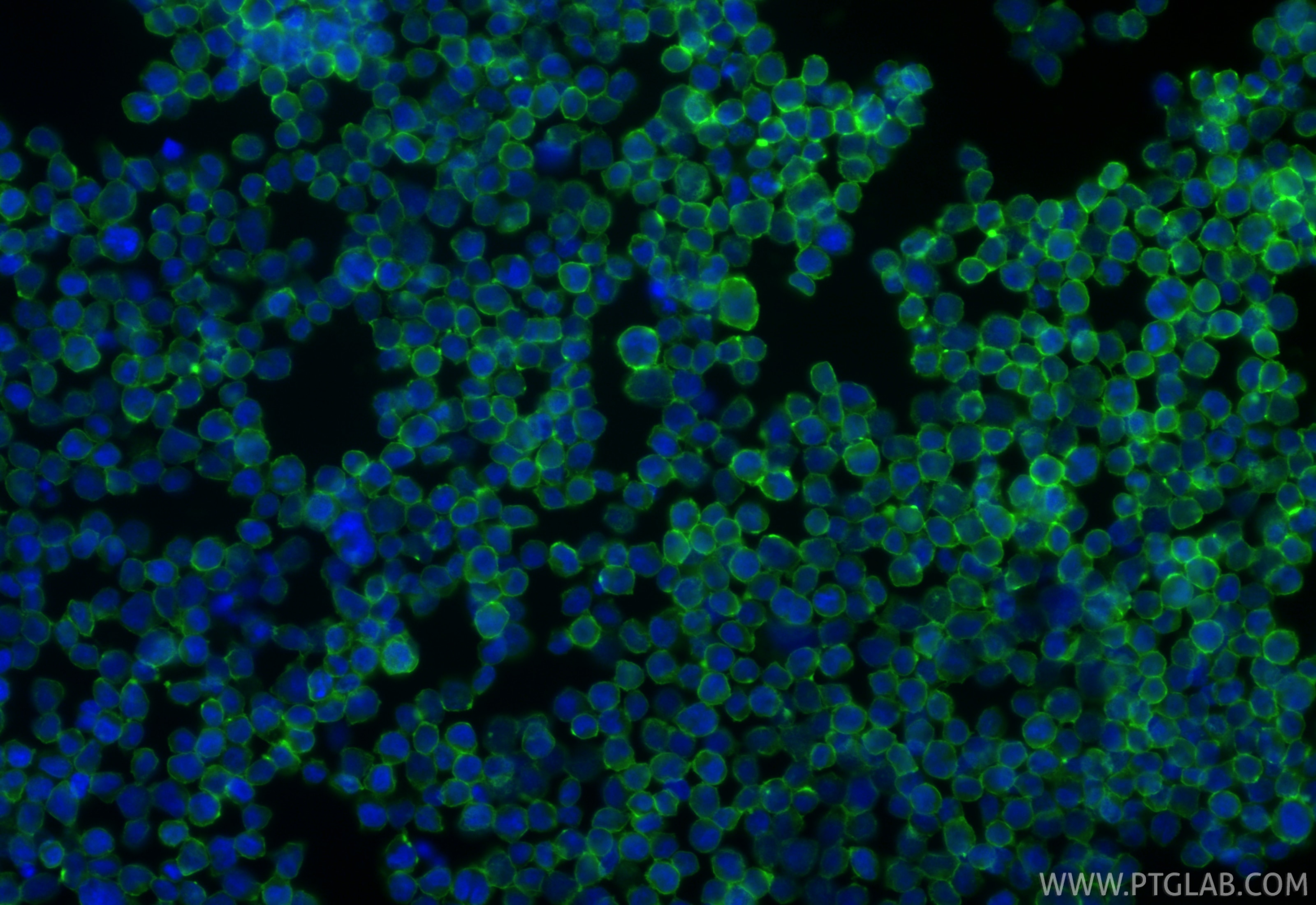 Immunofluorescent analysis of (4% PFA) fixed Jurkat cells using ICAM-2/CD102 antibody (84857-3-RR, Clone: 242237G11 ) at dilution of 1:200 and CoraLite®488-Conjugated Goat Anti-Rabbit IgG(H+L) (SA00013-2). This data was developed using the same antibody clone with 84857-3-PBS in a different storage buffer formulation. Immunofluorescence (IF) / fluorescent staining of Jurkat cells using ICAM-2/CD102 Recombinant monoclonal antibody (84857-3-RR)