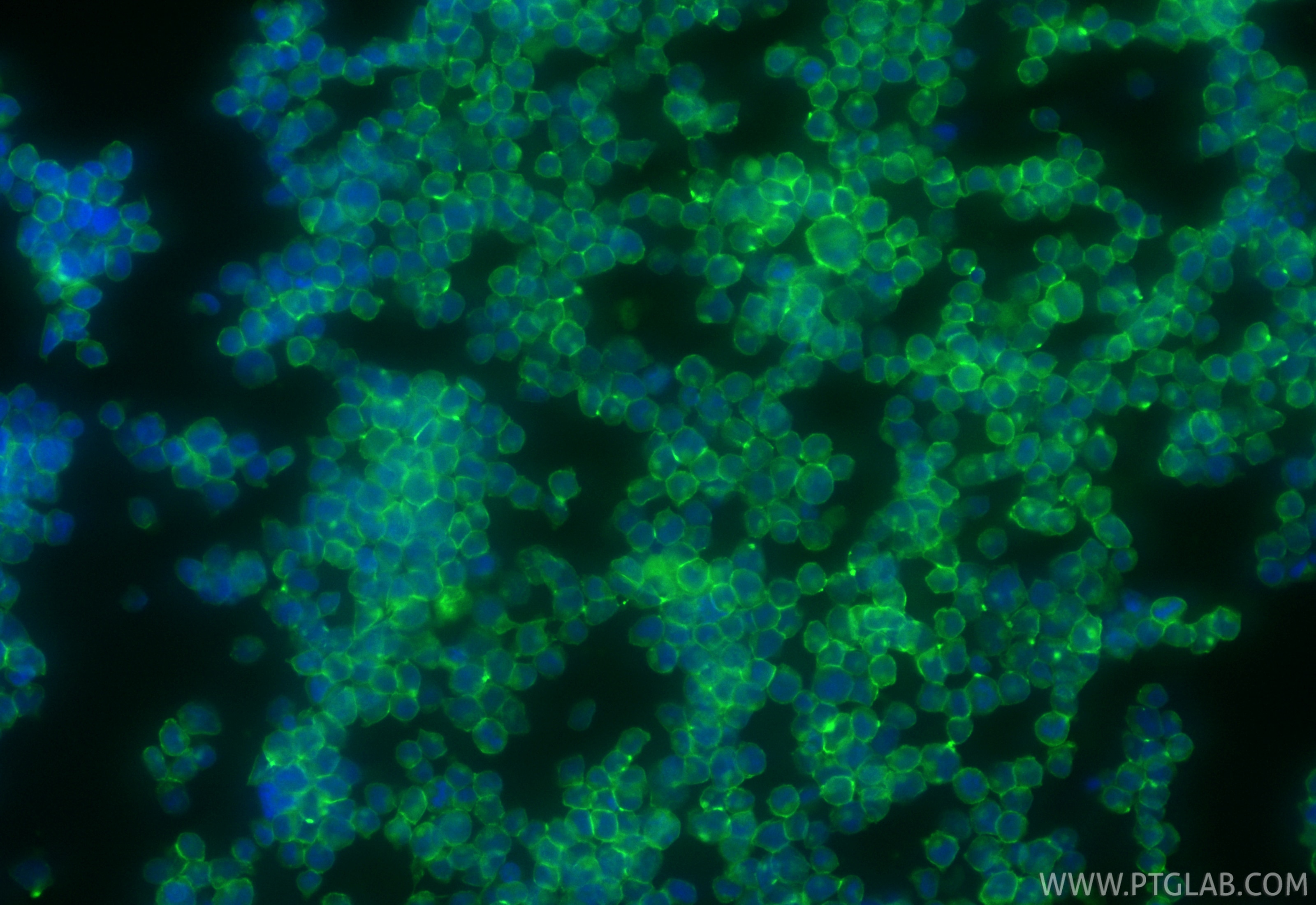Immunofluorescent analysis of (4% PFA) fixed Jurkat cells using CoraLite® Plus 488 ICAM-2/CD102 antibody (CL488-84857-2, Clone: 242237F8 ) at dilution of 1:200. Immunofluorescence (IF) / fluorescent staining of Jurkat cells using CoraLite® Plus 488-conjugated ICAM-2/CD102 Recombi (CL488-84857-2)