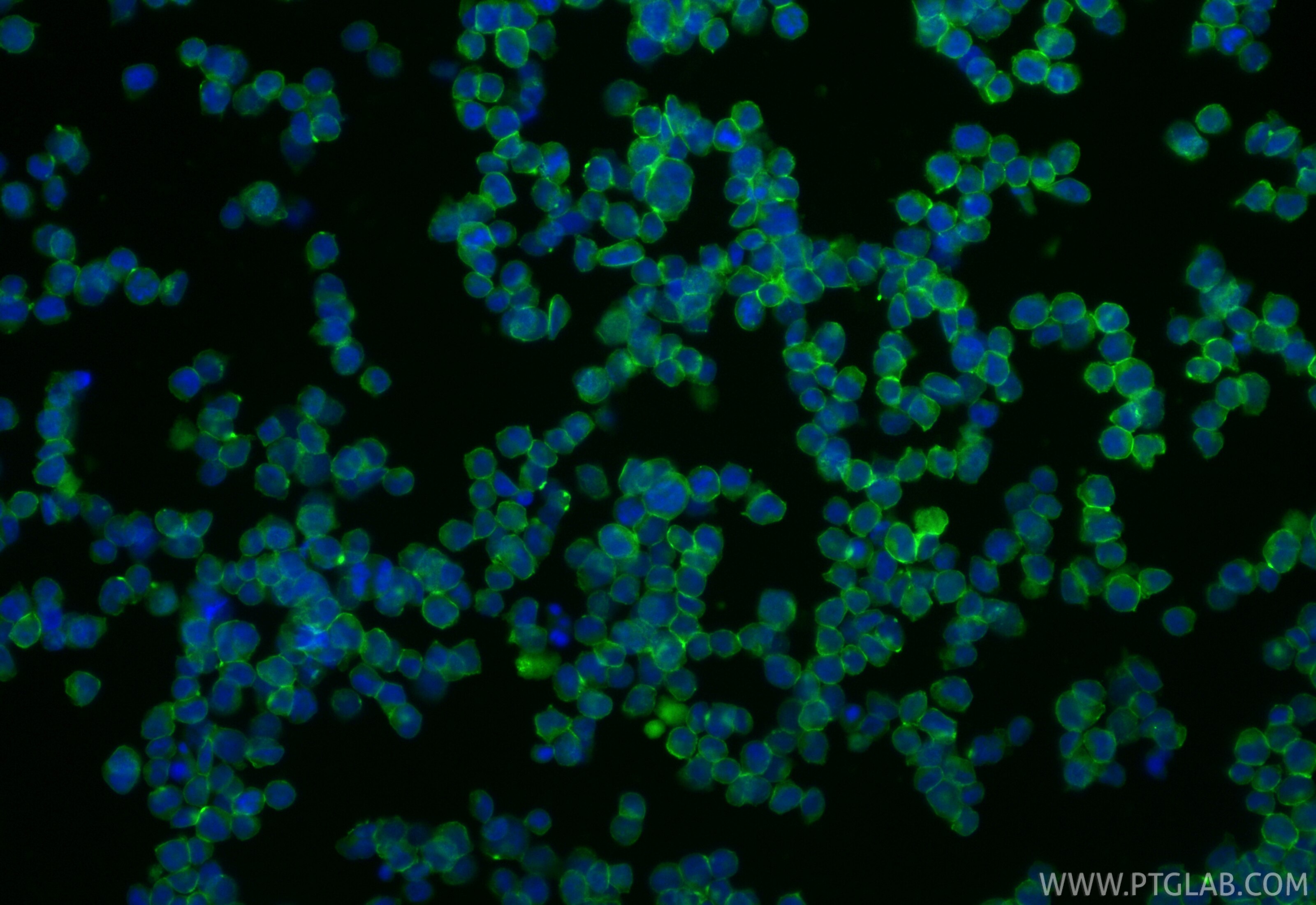 Immunofluorescent analysis of (4% PFA) fixed Jurkat cells using CoraLite® Plus 488 ICAM-2/CD102 antibody (CL488-84857-3, Clone: 242237G11 ) at dilution of 1:200. Immunofluorescence (IF) / fluorescent staining of Jurkat cells using CoraLite® Plus 488-conjugated ICAM-2/CD102 Recombi (CL488-84857-3)