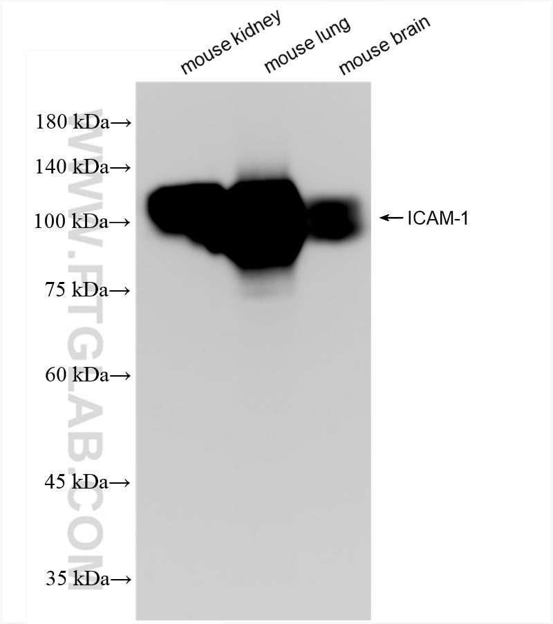 Western Blot (WB) analysis of various lysates using ICAM1 Recombinant antibody (82827-8-RR)