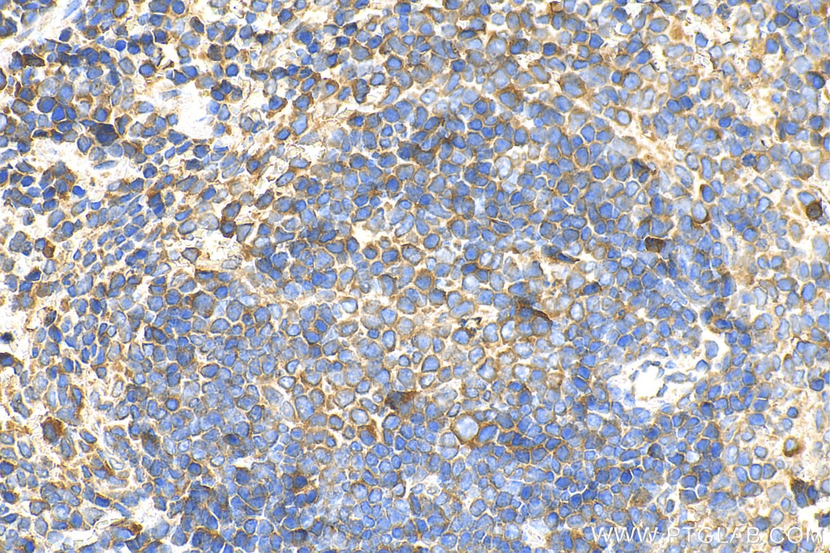 Immunohistochemistry (IHC) staining of mouse spleen tissue using ICAM2 Polyclonal antibody (10121-2-AP)