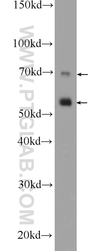 Western Blot (WB) analysis of RAW 264.7 cells using ICAM2 Polyclonal antibody (10121-2-AP)