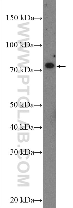 WB analysis of mouse brain using 10121-2-AP