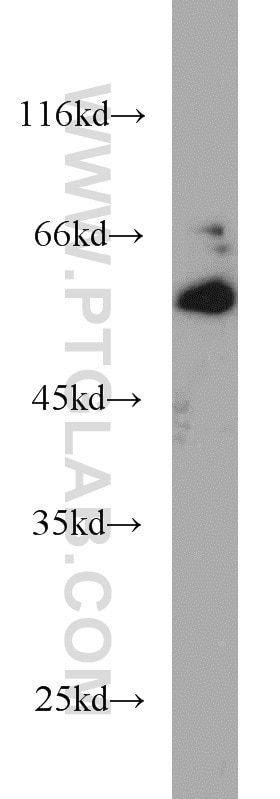 Western Blot (WB) analysis of Jurkat cells using ICAM2 Polyclonal antibody (10121-2-AP)