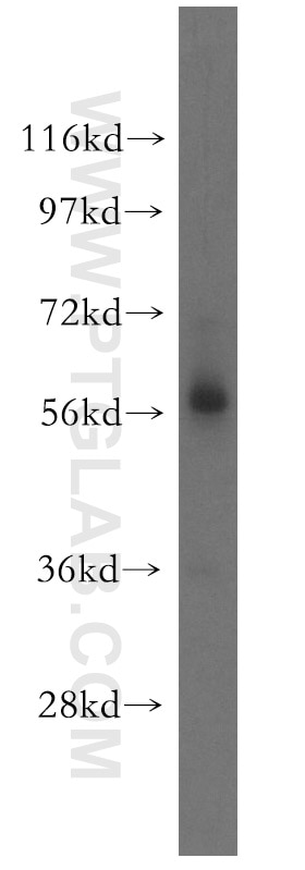 Western Blot (WB) analysis of HEK-293 cells using ICAM2 Polyclonal antibody (10121-2-AP)