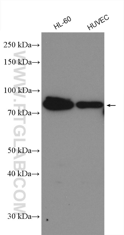 Western Blot (WB) analysis of various lysates using ICAM2 Polyclonal antibody (27322-1-AP)