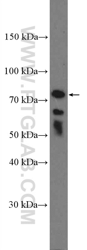 Western Blot (WB) analysis of Jurkat cells using ICAM2 Polyclonal antibody (27322-1-AP)
