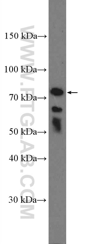 WB analysis of Jurkat using 27322-1-AP