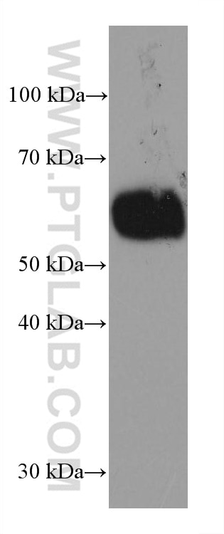 Western Blot (WB) analysis of Jurkat cells using ICAM2 Monoclonal antibody (67628-1-Ig)