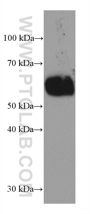WB analysis of Jurkat using 67628-1-Ig