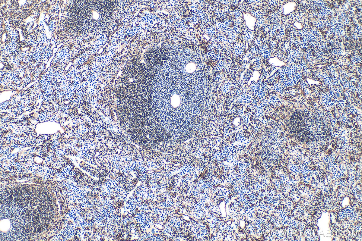 Immunohistochemistry (IHC) staining of mouse spleen tissue using ICAM2/CD102 Polyclonal antibody (31950-1-AP)