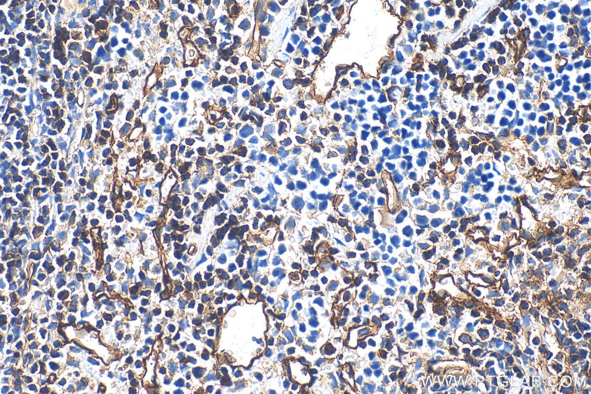 Immunohistochemistry (IHC) staining of mouse spleen tissue using ICAM2/CD102 Polyclonal antibody (31950-1-AP)