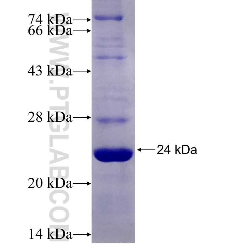 ICAM2 fusion protein Ag29441 SDS-PAGE