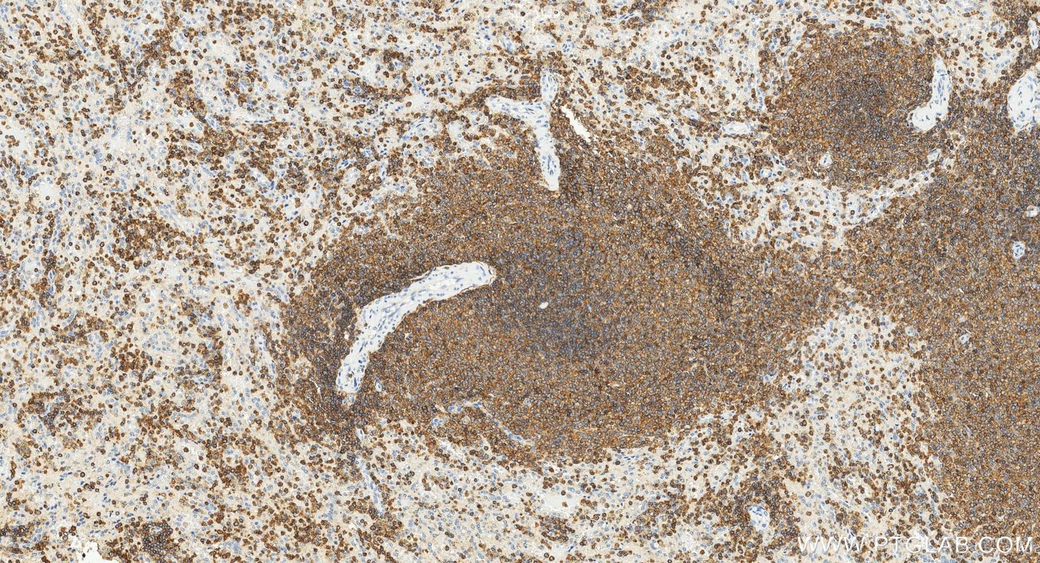 Immunohistochemistry (IHC) staining of human spleen tissue using ICAM3/CD50 Polyclonal antibody (17699-1-AP)