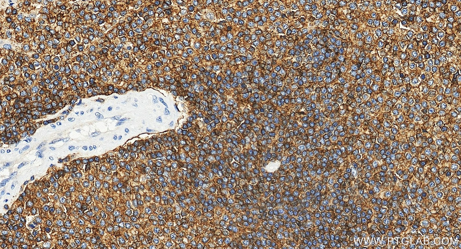 Immunohistochemistry (IHC) staining of human spleen tissue using ICAM3/CD50 Polyclonal antibody (17699-1-AP)