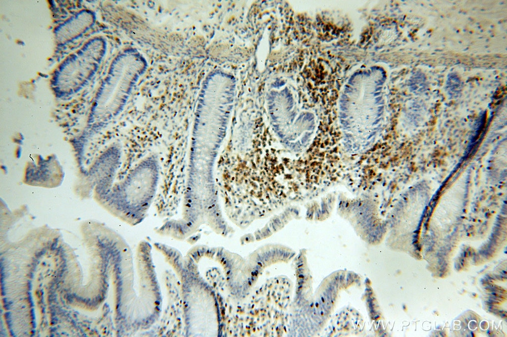 Immunohistochemistry (IHC) staining of human colon tissue using ICAM3 Polyclonal antibody (17699-1-AP)