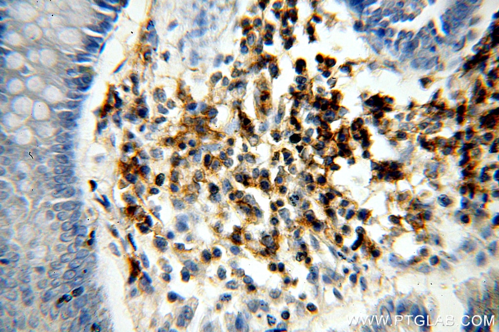 IHC staining of human colon using 17699-1-AP