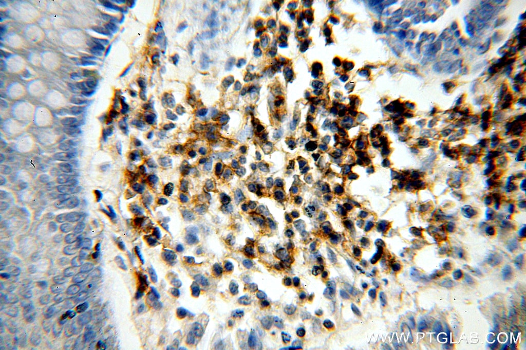 Immunohistochemistry (IHC) staining of human colon tissue using ICAM3 Polyclonal antibody (17699-1-AP)