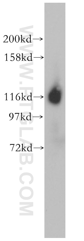 Western Blot (WB) analysis of Jurkat cells using ICAM3 Polyclonal antibody (17699-1-AP)