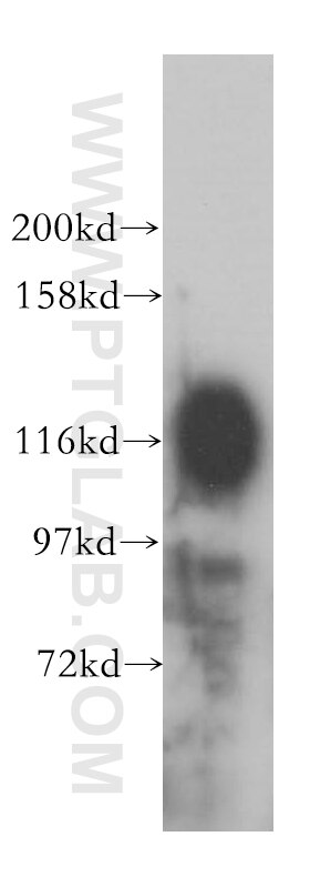 Western Blot (WB) analysis of U-937 cells using ICAM3 Polyclonal antibody (17699-1-AP)