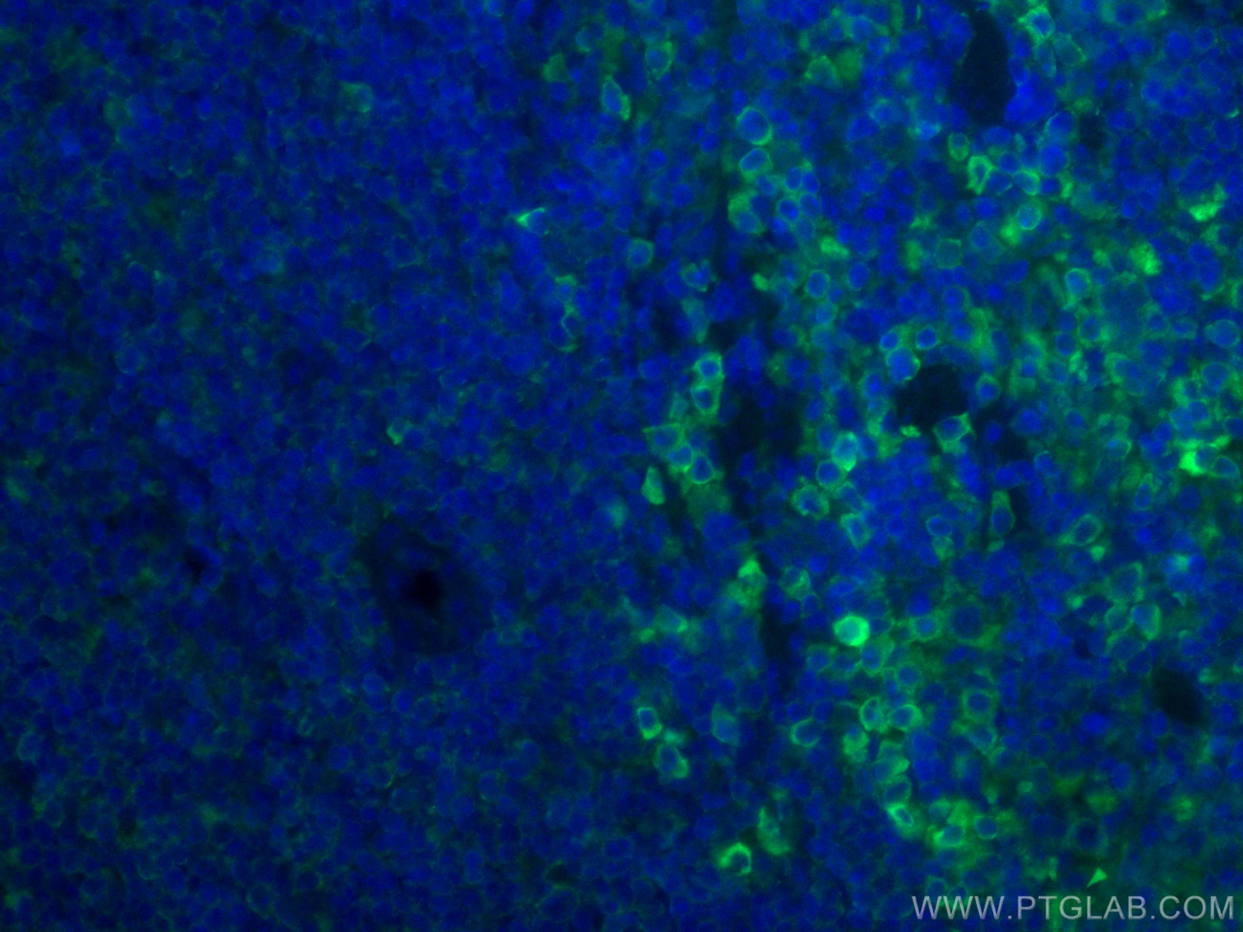 Immunofluorescence (IF) / fluorescent staining of mouse spleen tissue using ICAM4 Monoclonal antibody (67014-1-Ig)