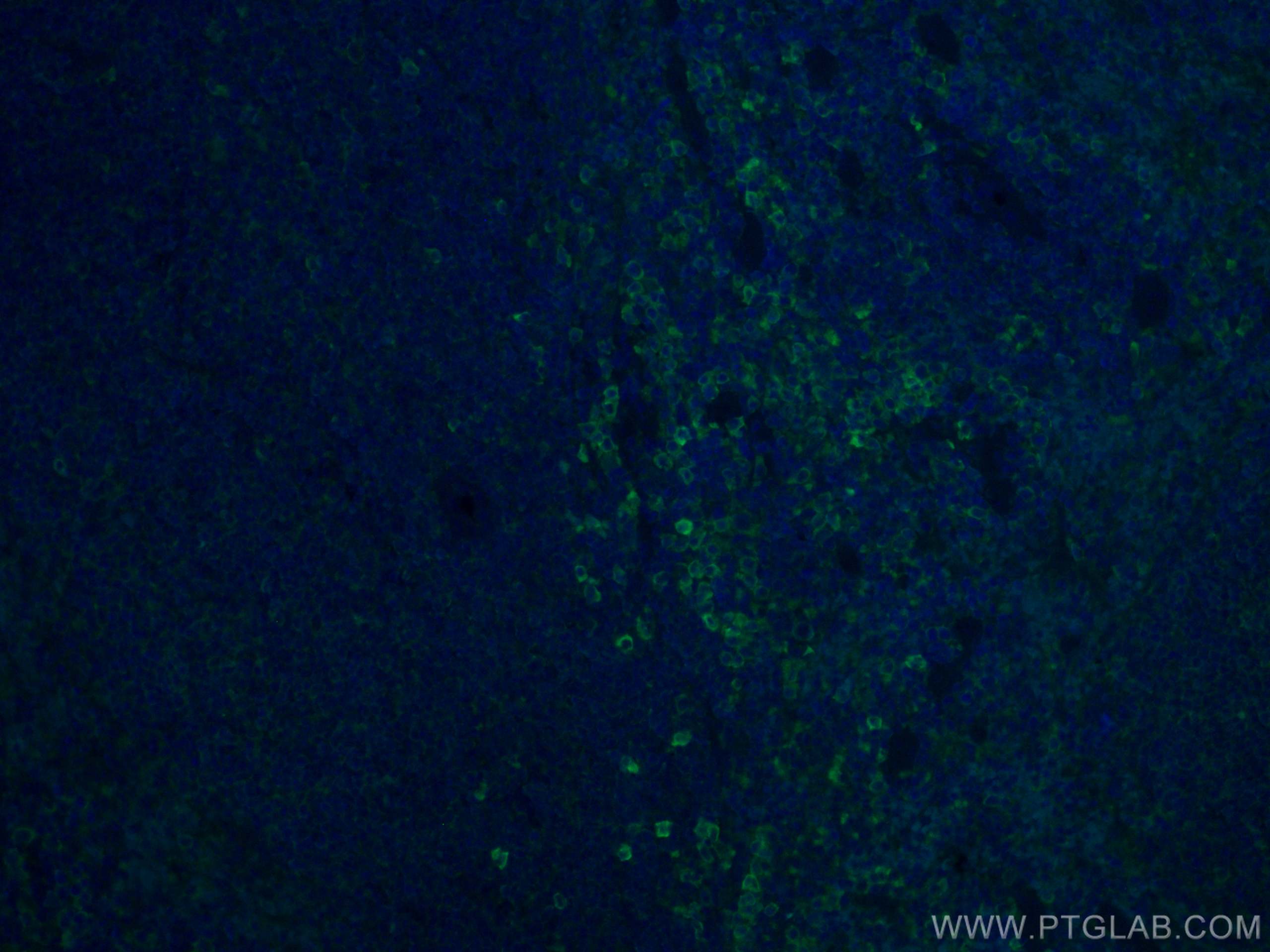 Immunofluorescence (IF) / fluorescent staining of mouse spleen tissue using ICAM4 Monoclonal antibody (67014-1-Ig)