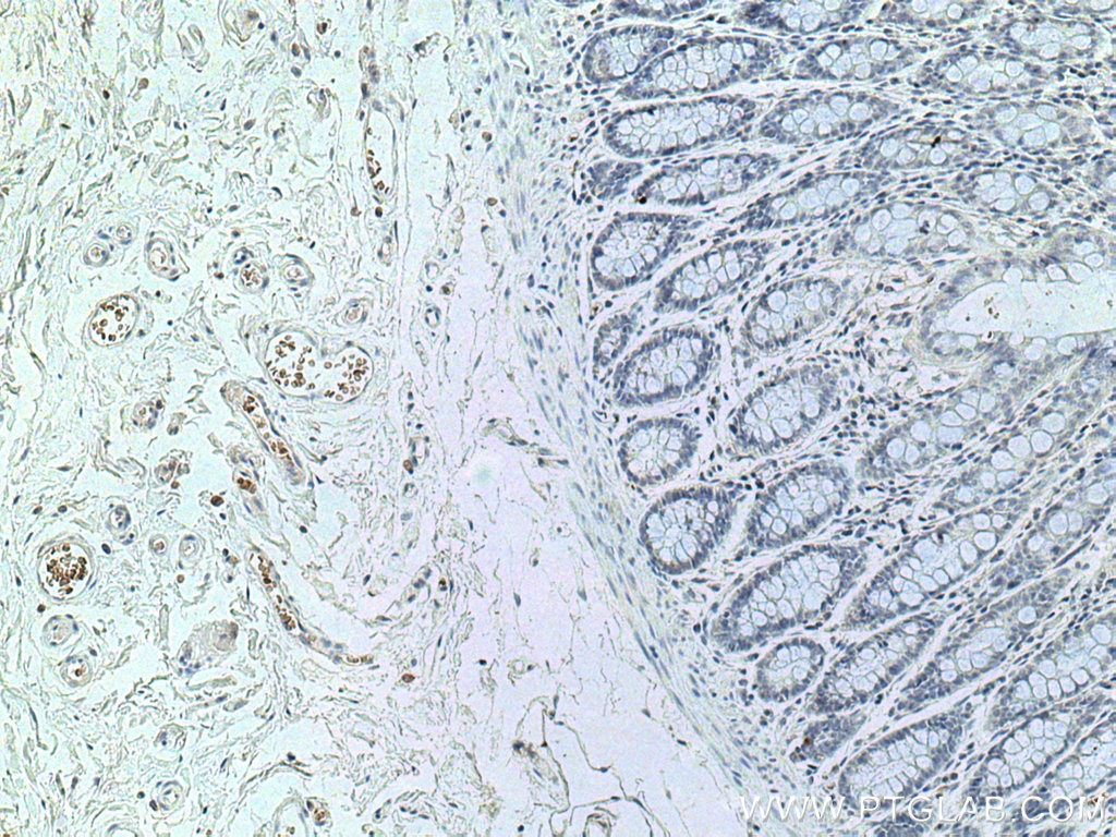 Immunohistochemistry (IHC) staining of human colon tissue using ICAM4 Monoclonal antibody (67014-1-Ig)