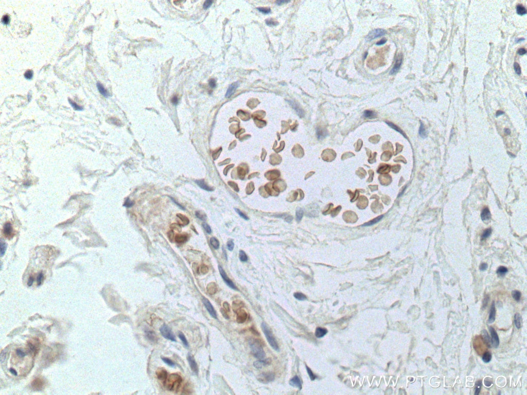 Immunohistochemistry (IHC) staining of human colon tissue using ICAM4 Monoclonal antibody (67014-1-Ig)
