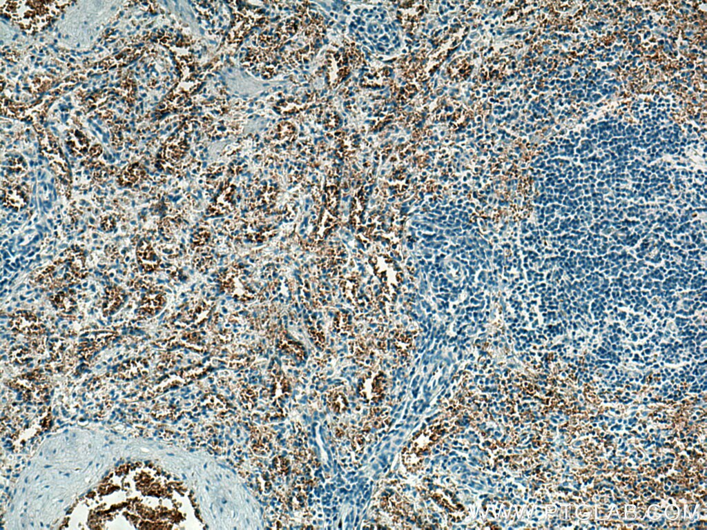Immunohistochemistry (IHC) staining of human spleen tissue using ICAM4 Monoclonal antibody (67014-1-Ig)