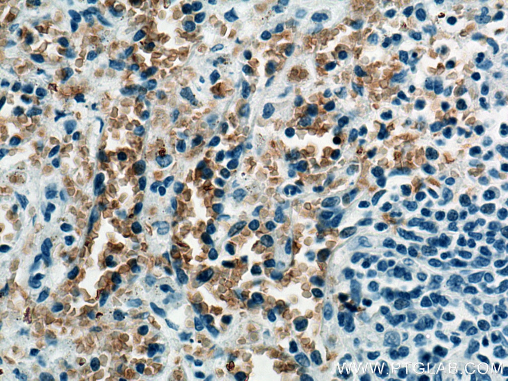 IHC staining of human spleen using 67014-1-Ig