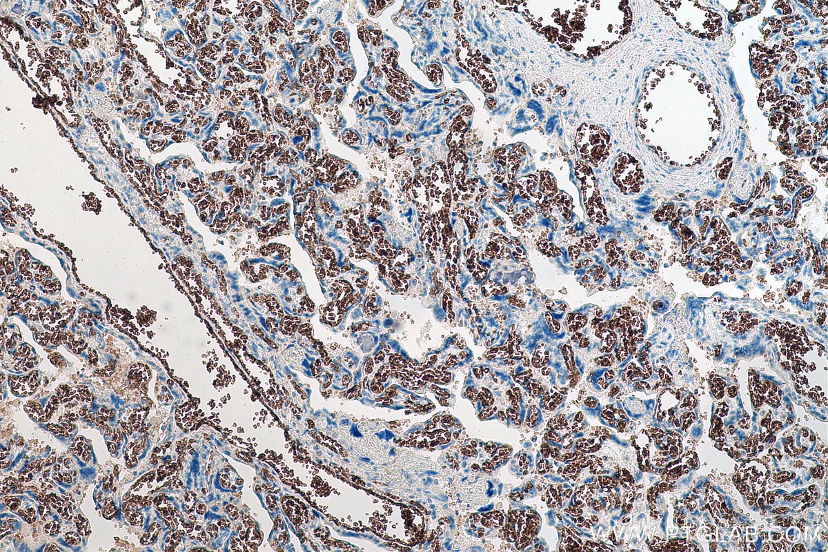 IHC staining of human placenta using 67014-1-Ig