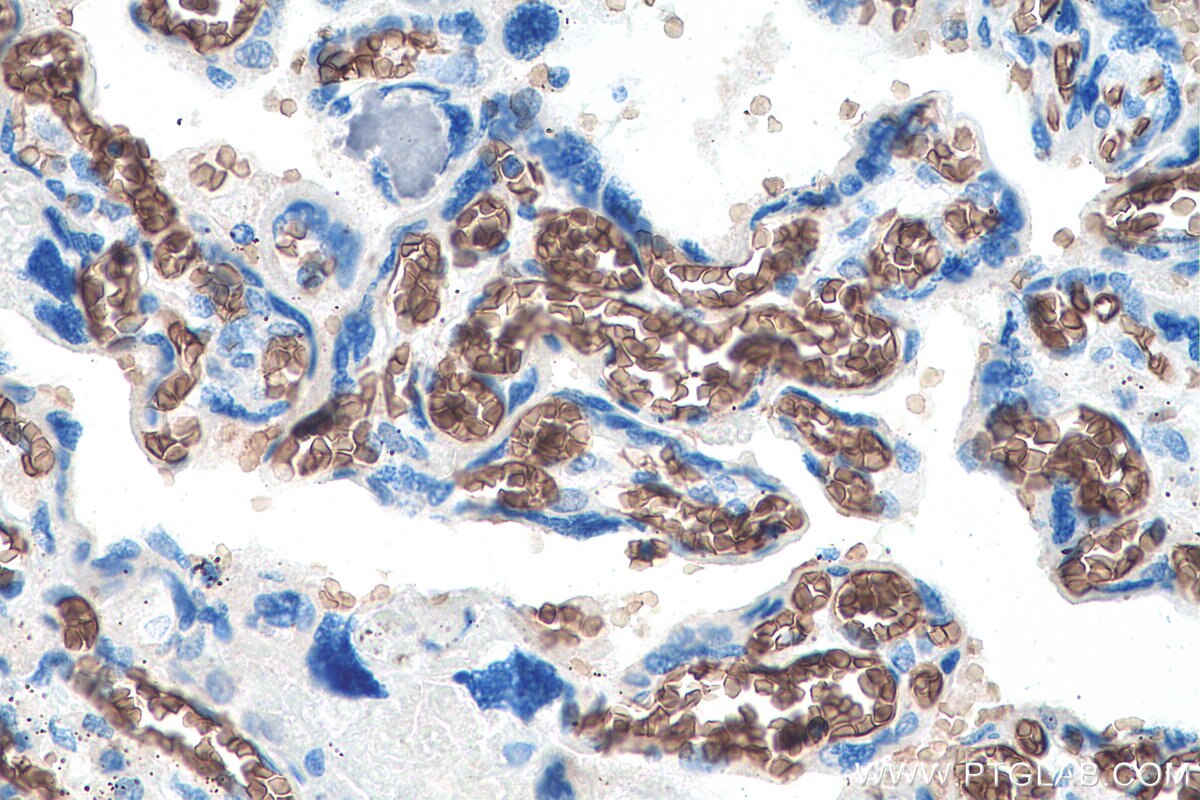 Immunohistochemistry (IHC) staining of human placenta tissue using ICAM4 Monoclonal antibody (67014-1-Ig)